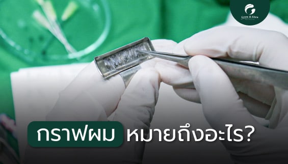 กราฟผมหมายถึงอะไร