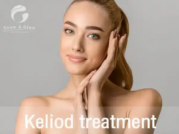 Keloid treatment