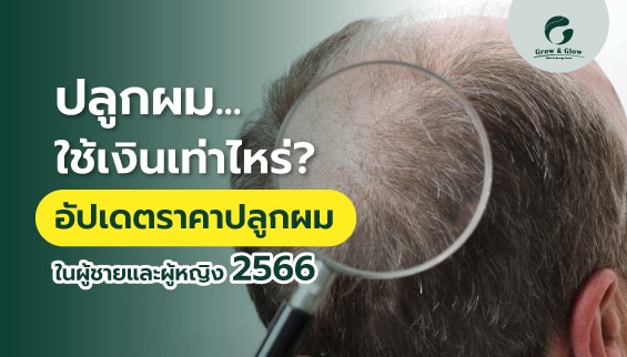 ปลูกผมใช้เงินเท่าไหร่? อัปเดตราคาปลูกผมในผู้ชายและผู้หญิง 2566