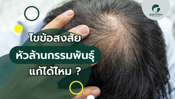 หัวล้านกรรมพันธุ์แก้ได้ไหม