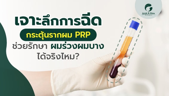 รู้จักการฉีดกระตุ้นรากผมด้วยเกล็ดเลือดเข้มข้น PRP