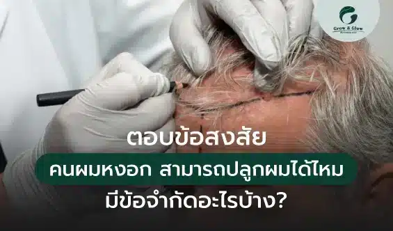 ตอบปัญหาคนผมหงอก สามารถปลูกผมได้ไหม