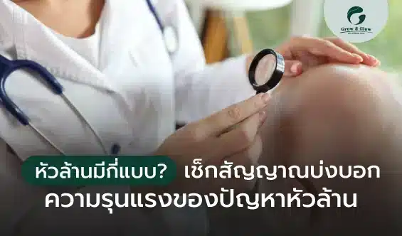 หัวล้านมีกี่แบบ? เช็กสัญญาณบ่งบอกความรุนแรงของปัญหาหัวล้าน