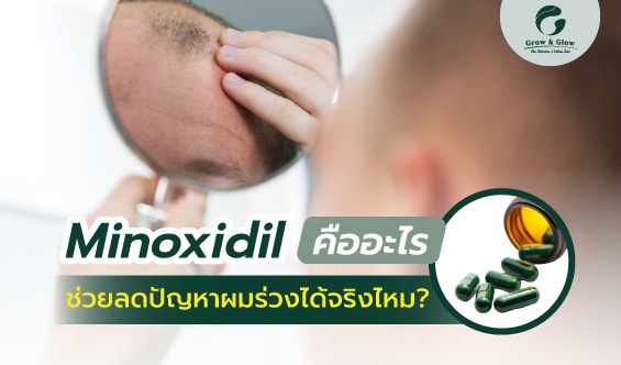 ไขข้อสงสัย ! Minoxidil คืออะไร แก้ผมร่วงได้จริงไหม