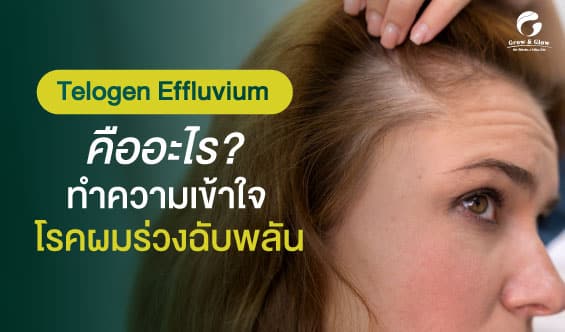 Telogen Effluvium คืออะไร ? รู้ทันก่อนเป็นโรคผมร่วงฉับพลัน