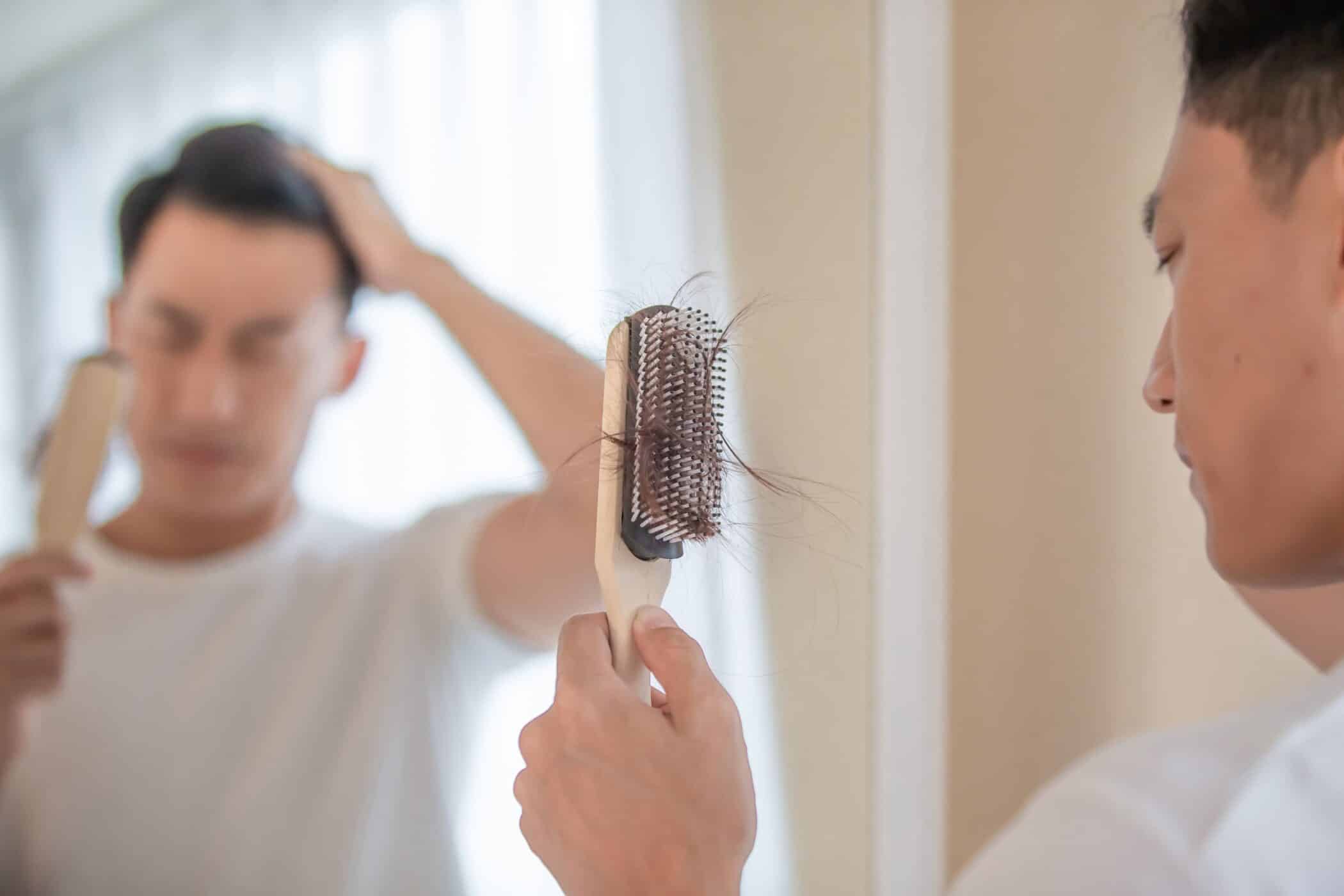 The DHT hormone can cause hair loss in adult men