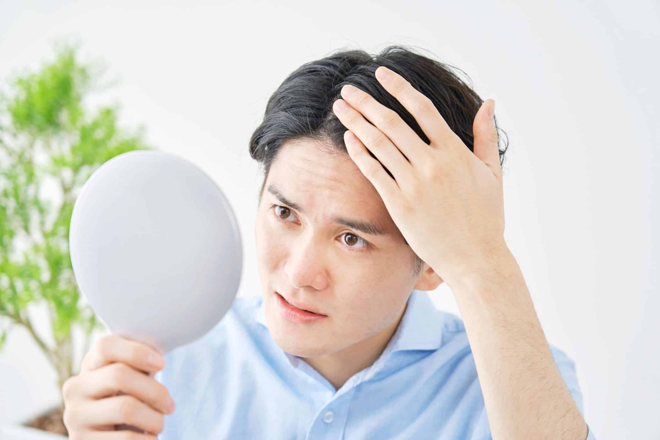 Hair loss can be traumatic for men