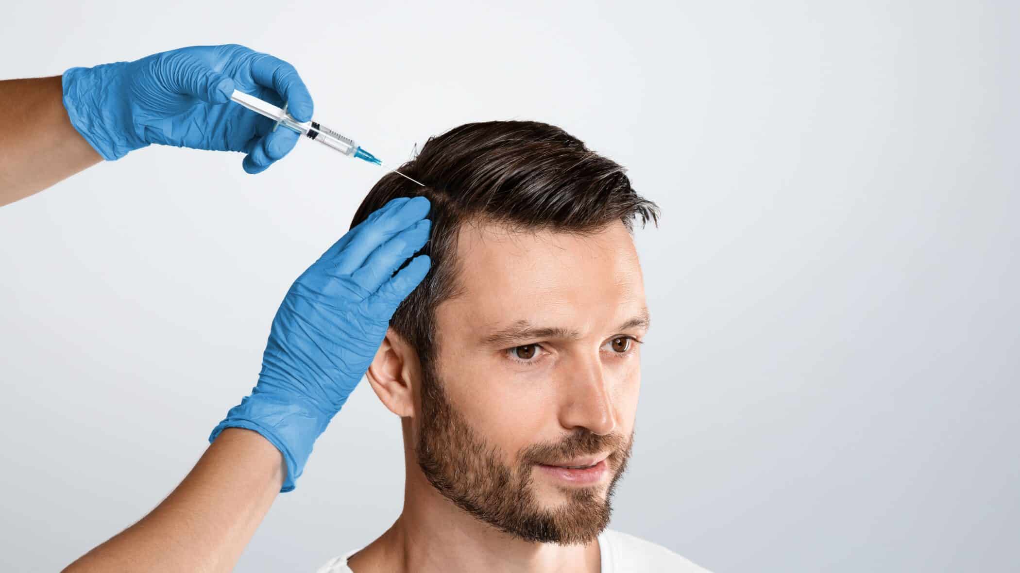 PRP injections can stimulate hair growth