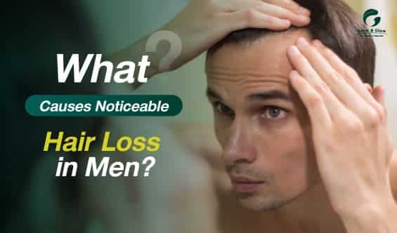 Men’s Hair Loss Causes and Treatments