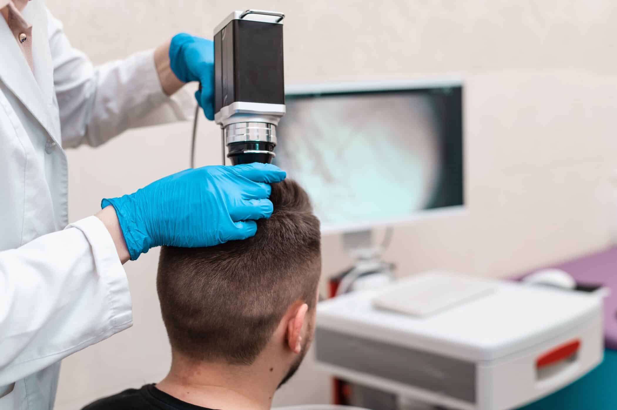 A healthcare professional examines the hair loss condition of a patient, with a monitor displaying results in the background.