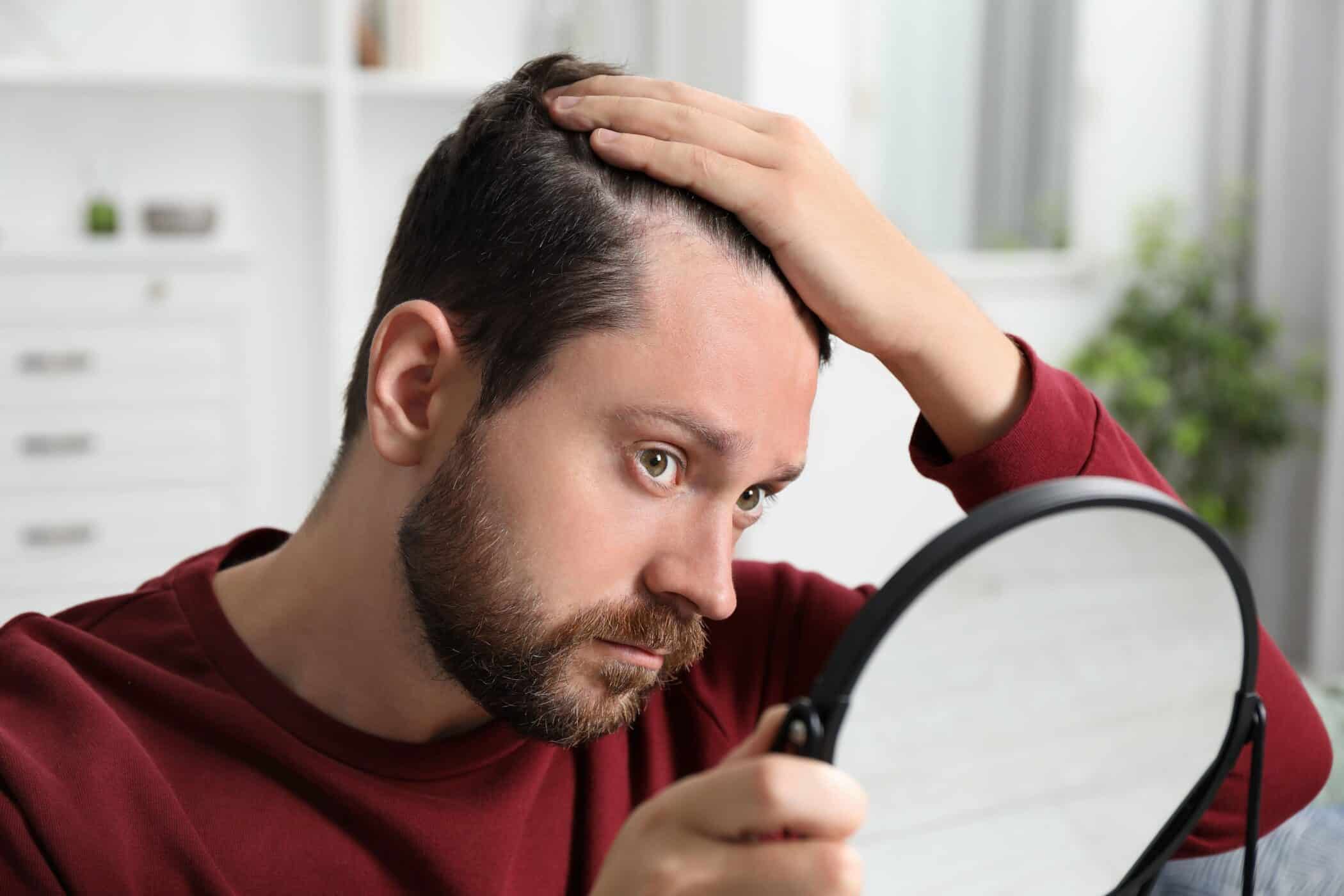 A man in a red sweater holds a mirror, examining his hair while touching his scalp.