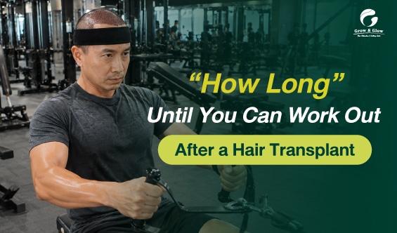 Can You Work Out After a Hair Transplant? Timing and Tips