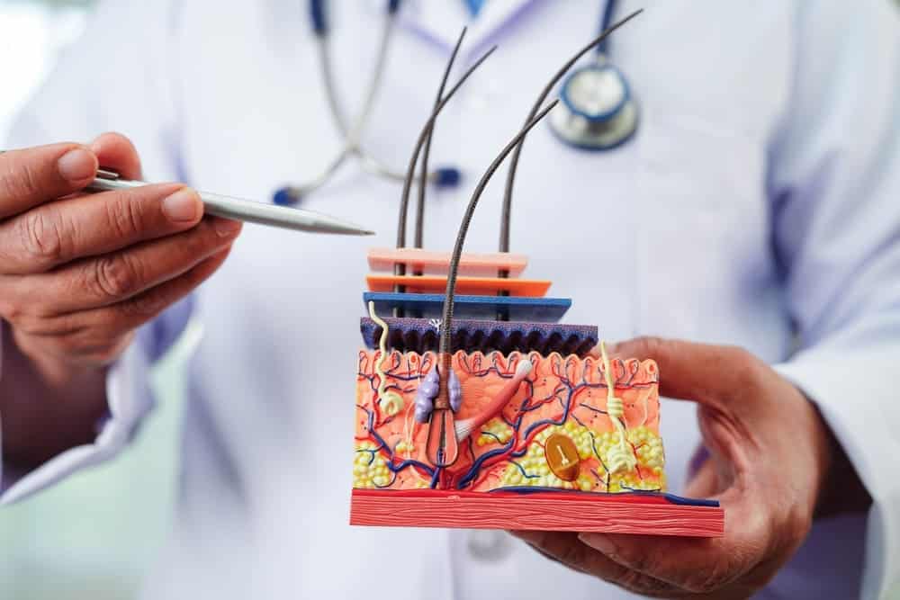 A doctor holds a skin structure model to illustrate how Asian hair transplants are different.