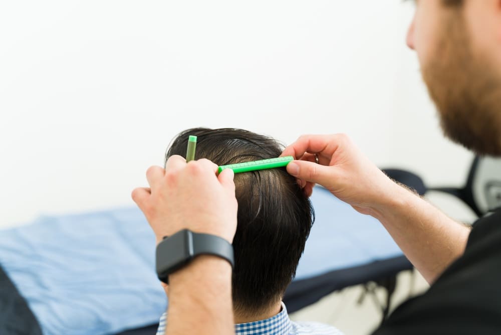 Scalp assessment to determine if you can work after a hair transplant