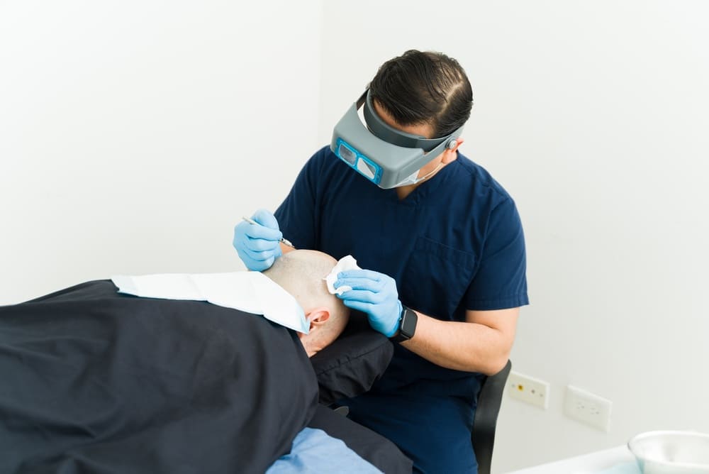 Patient undergoing a hair transplant after vitamin E and topicals did not work for his hair loss