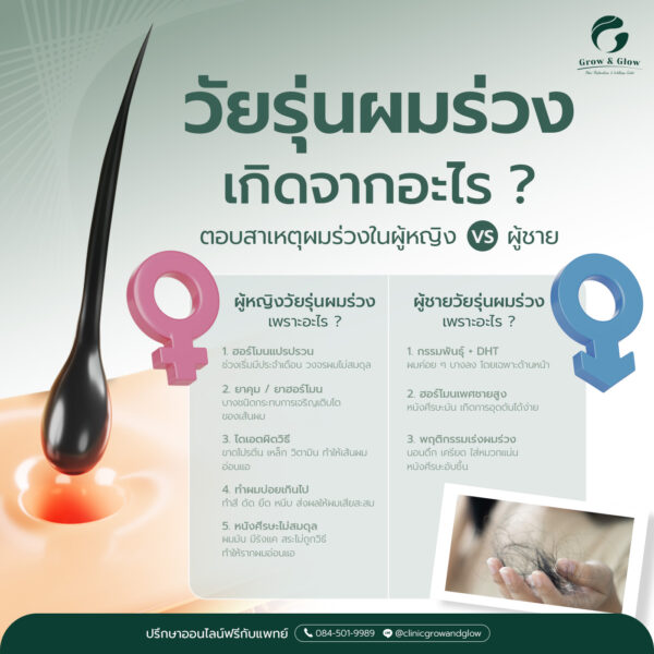 สรุปสาเหตุผมร่วงผู้หญิงวัยรุ่น และสาเหตุผมร่วงผู้ชายวัยรุ่น