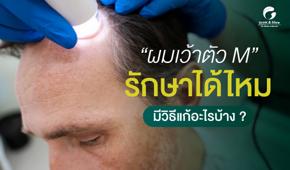 หน้าผากรูปตัว M แก้ไขได้ ! เคล็ดลับปรับแนวผมให้ดูดีขึ้น