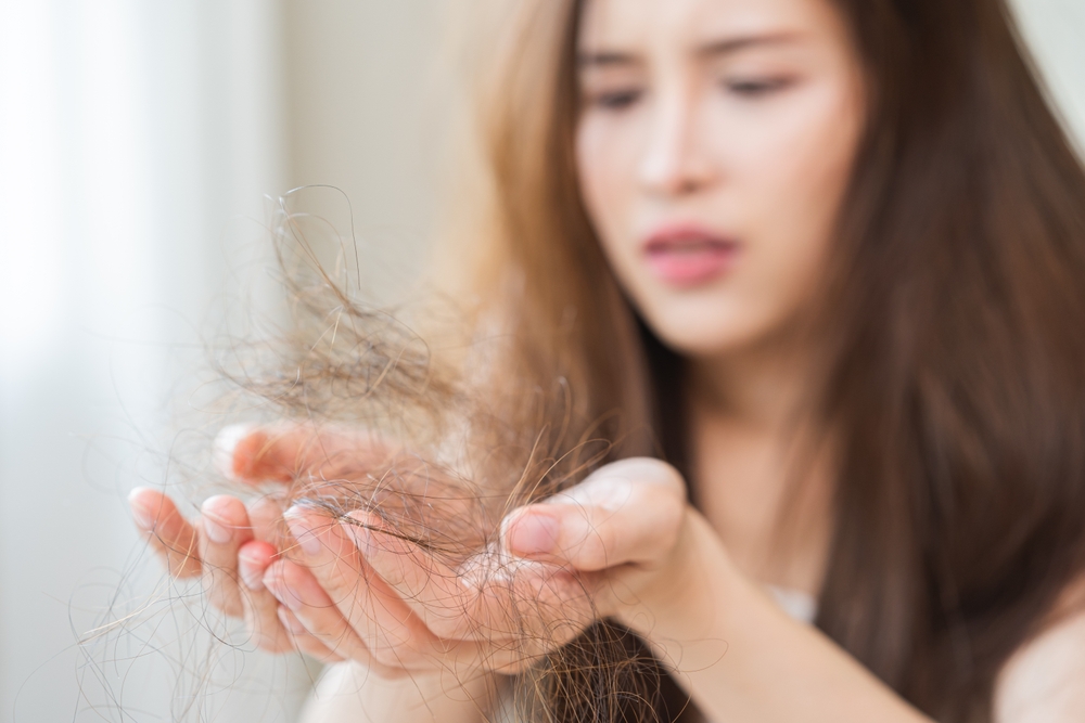 A young woman holds up shed hair caused by telogen effluvium.