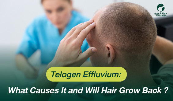 Telogen Effluvium: What Causes It and Will Hair Grow Back?