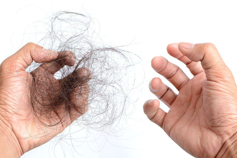 Close up of a man's hand holding a chunk of hair after washing, showing visible hair loss