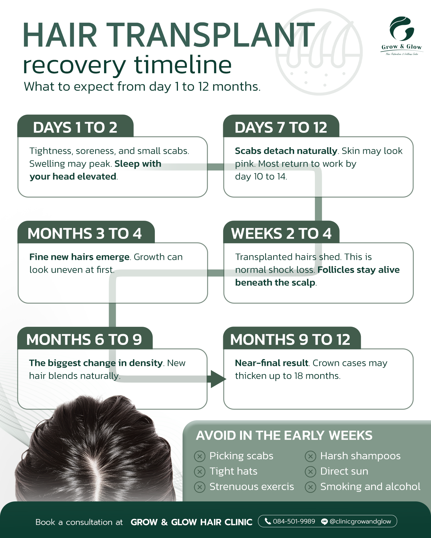 Infographic showing the hair transplant recovery timeline from day one to twelve months
