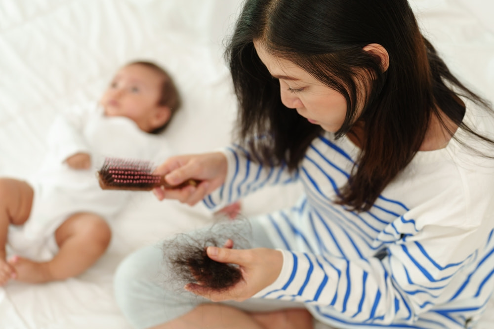 A young mother holding a hairbrush and shed hair, experiencing hair loss after pregnancy