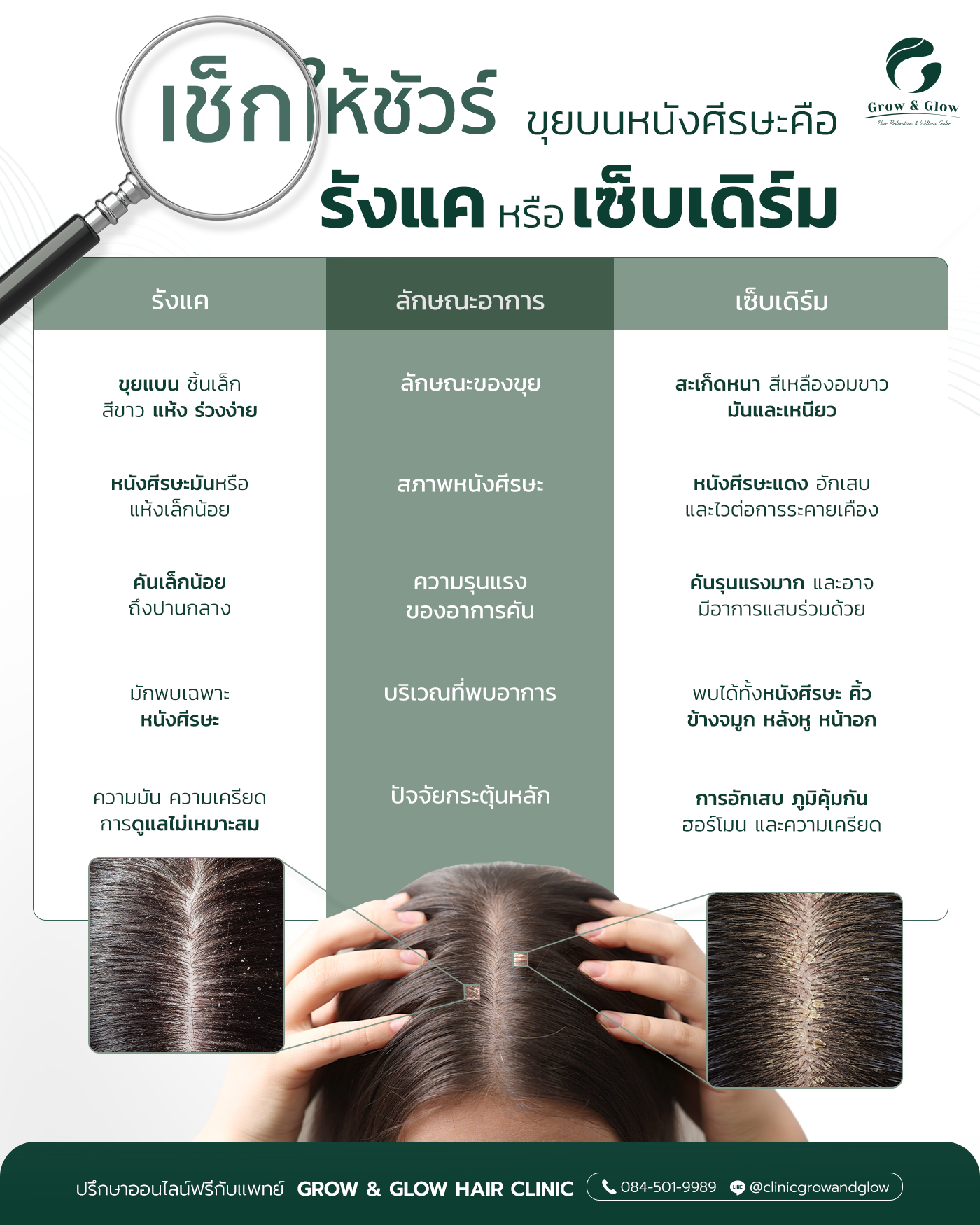 เปรียบเทียบรังแคกับเซ็บเดิร์ม ต่างกันอย่างไร เข้าใจให้ชัดก่อนดูแล