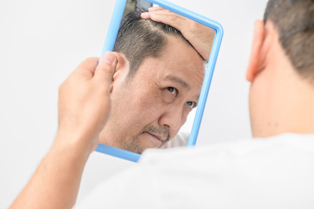 Man inspecting hairline progress in mirror for hair transplant timeline.