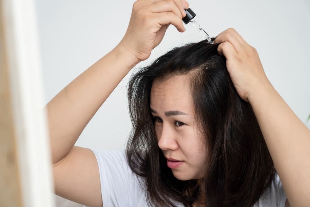 Woman applying treatment for how long does minoxidil take to work.