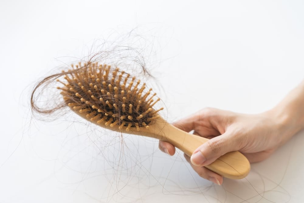 Hairbrush with fallen hair during minoxidil shedding phase