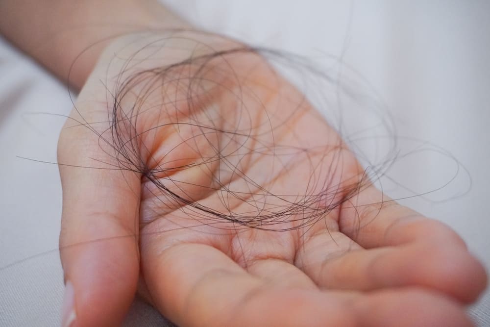 Clump of hair on hand caused by minoxidil shedding